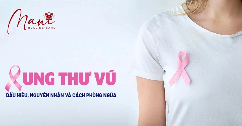 Kiến thức về ung thư vú